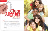 Clear Aligner by Dentist Bolingbrook IL