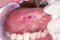 Gum Disease Therapy Bolingbrook IL