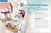 Periodontal Surgery by Dentist Bolingbrook IL